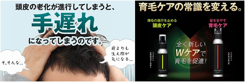 RHIZOGAIN(リゾゲイン)プレミアム育毛キット情報サイト